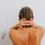 Skælshampoo